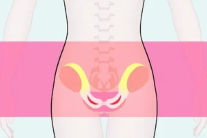 What Is a FUPA on a Woman